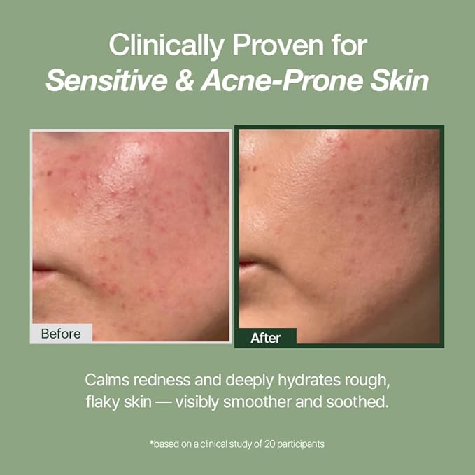 NDP Green Caper Milky Toner Essence - Hydrating Korean Toner for Face, Deep Moisture for Sensitive and Dry Skin, Panthenol, Madecassoside (4.39 Fl oz / 130ml)