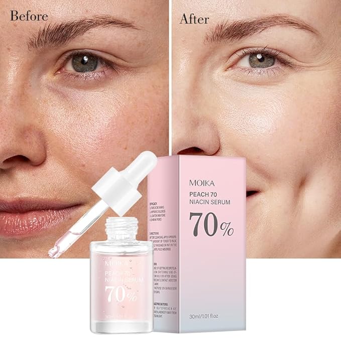 Peach 70 Niacinamide Serum, Hydrating Face Serum, Facial Serum for Oily Skin, Daily Clean For Women (30ml)