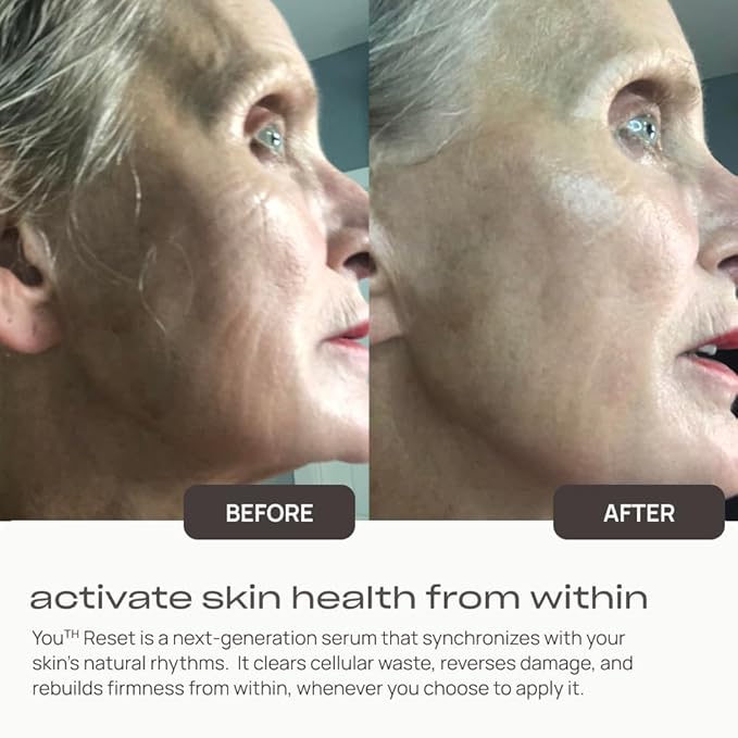 Young Goose, Youth Reset Serum | Cellular Regeneration and Repair | Improves Skin Texture | Promotes Skin Luminosity and Vibrancy - Large Size 30ml