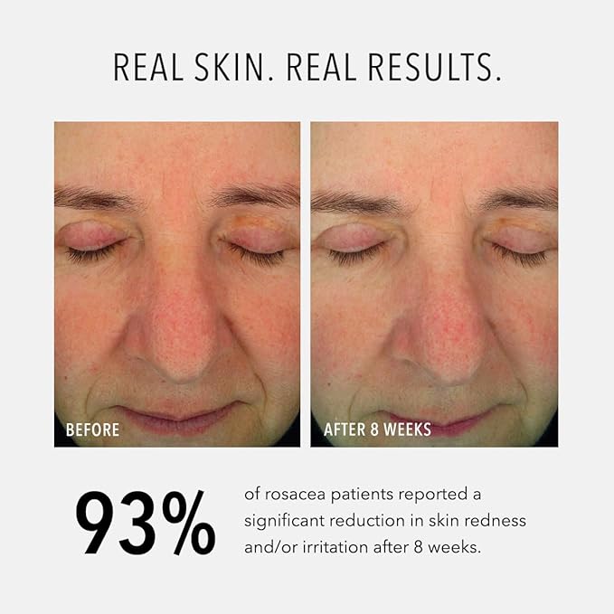 Hydropeptide Soothing Serum, Moisturizing & Anti-Aging Peptide Facial Serum, 1 Ounce