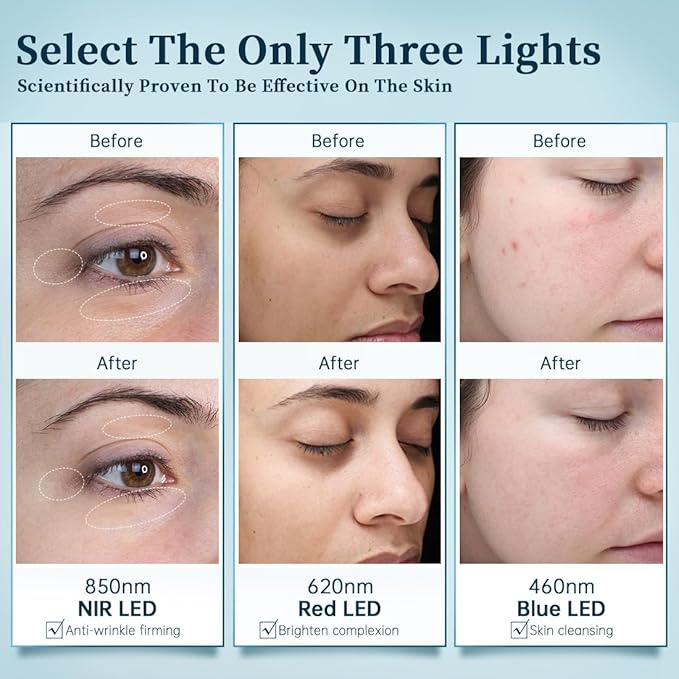 GYH 8-Color LED Face Mask Light Therapy, Red Light Therapy for Face, FSA/HSA Eligible, Wireless High Dose Green, Blue, Infrared Light Therapy Mask for Skin Care & Anti-aging, Cloud-SSS (RB-081)