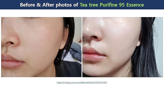Dr.Ceuracle Tea Tree Purifine Essence - Mild Facial Serum for Sensitive Skin, Redness and Sebum Reducing Korean Skin Care (50ml / 1.69 fl. oz.)