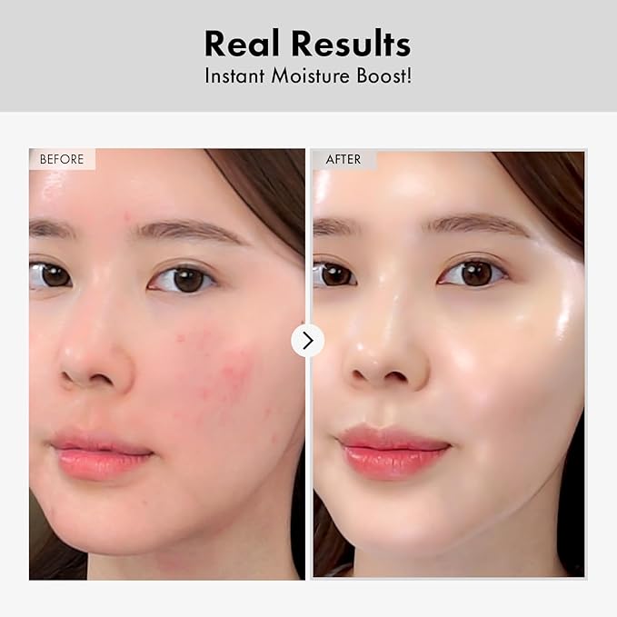 TOSOWOONG Hyaluronic Acid Ampoule, Hydrating Glow and Skin Barrier Protection, Anti-Aging Face Serum for Dry Skin, Korean Skincare Beauty Products, 100ml, 3.38 fl. oz.