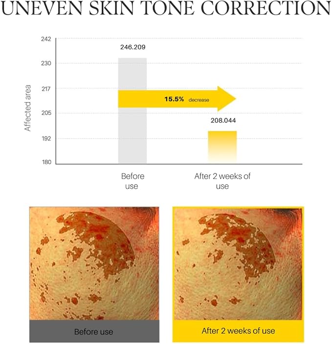 d'alba Piedmont White Truffle Vita Toning Serum Toner, Glass Skin with Double Vitamin Skincare, Face Moisturizer, (6.08fl. oz)