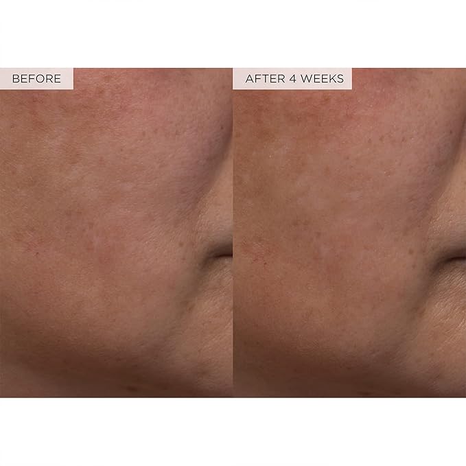 Glow Recipe PHA + BHA Face Toner - Korean Skin Care Pore Minimizer & Gentle Facial Exfoliator for Tightening, Hydrating & Exfoliating - Glycerin, Watermelon & Cactus Water (40ml)