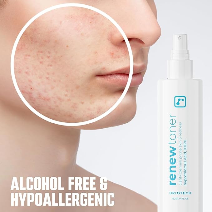 BRIOTECH Renew Toner, Hypochlorous Acid Spray, Minimize Appearance of Blemishes, Soothing Facial Mist for Sensitive Skin, Calm Redness & Bumps, Vegan, 2 fl oz Travel Size