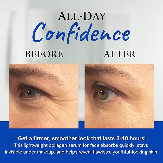 BioLogic LifTight Instant Face Lift Serum - Anti Aging Serum for Face & Instant Eye Lift – Reduces Wrinkles, Firms Sagging Skin, Smooths Crow’s Feet & Fine Lines in Minutes - 0.5 Fl Oz - Pack of 2