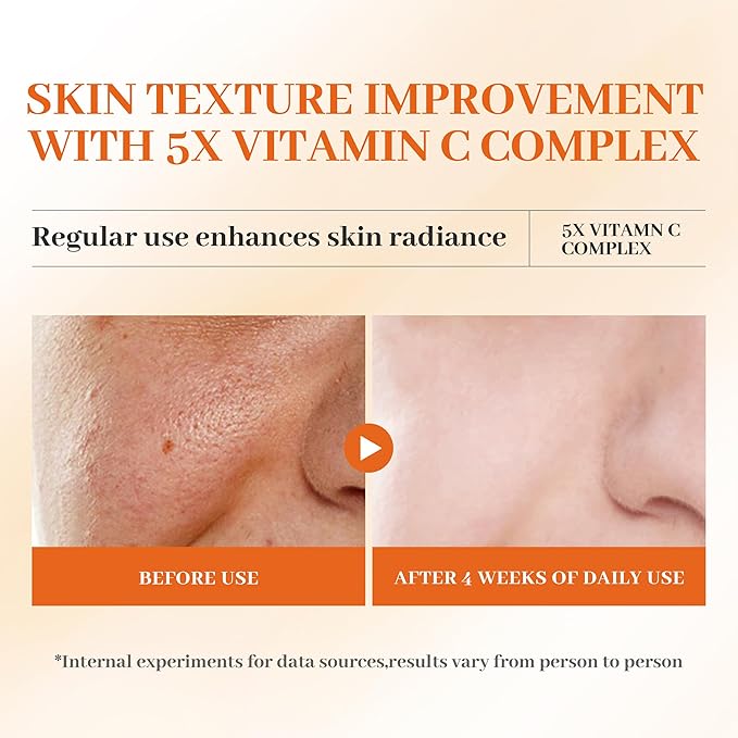 Vitamin C Gloss Serum,HONLINK Face Essence - Stabilized Complex with Hyaluronic Acid & Centella Dull Facial Skin,Uneven Tone,Fine Lines,Pores, Dry Skin,TK Popular Skincare,Unique Gift for Women