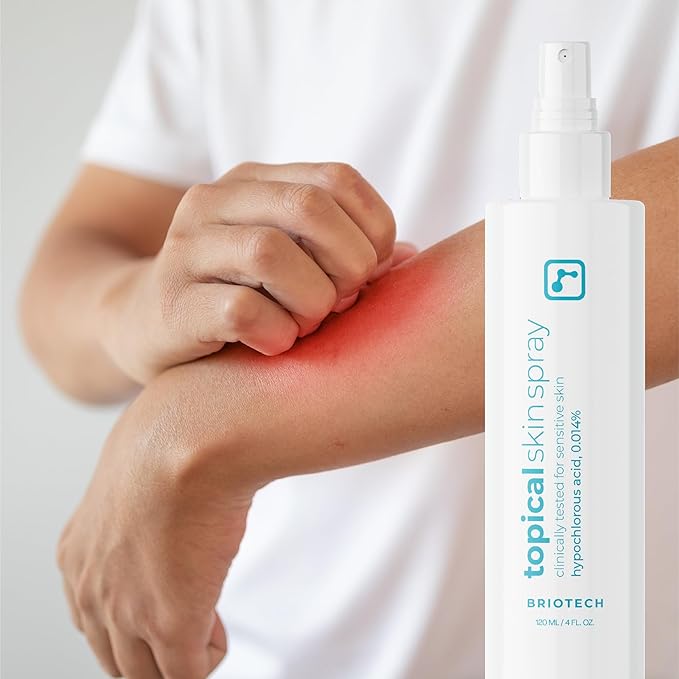 BRIOTECH Topical Skin Spray, Hypochlorous Acid Spray for Sensitive Skin, HOCl Facial Mist, Full Body Support Against Irritation, Calm Redness, Soothe Foot & Scalp, 4 oz (2 Pack)