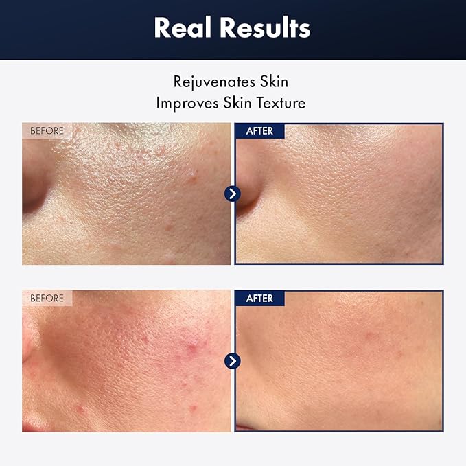 TOSOWOONG Black Snail Plus Essence With 960,890ppm Black Snail Secretion Filtrate, Hydrating Serum, Repairing, Anti Aging, Dull Skin, Fine Lines, Sensitive Skin, Korean Skin Care, 100ml, 3.38 fl.oz.