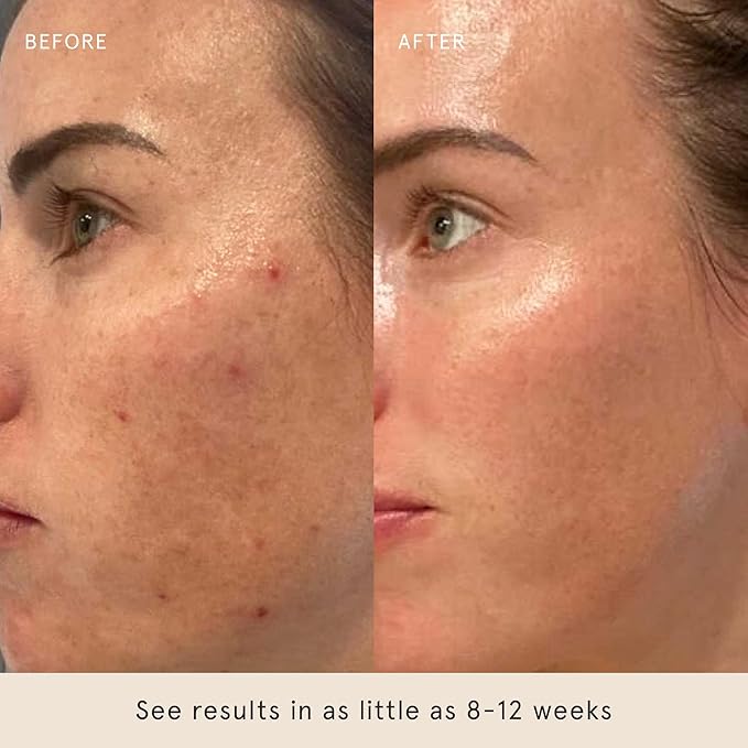 Barefaced Serum Trio - Liquid Gold, Overachiever, RetinAL - Powerful Ingredients for Healthier, Smoother Skin