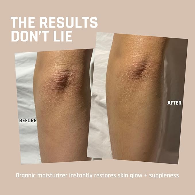 Whipped Organic Grass-Fed Beef Tallow for Skin - 100% Pure, Non-Greasy, Natural Beef Tallow Moisturizer for Face and Body. Honey Beef Tallow Balm – Soothes Sensitive Skin, Absorbs Quickly