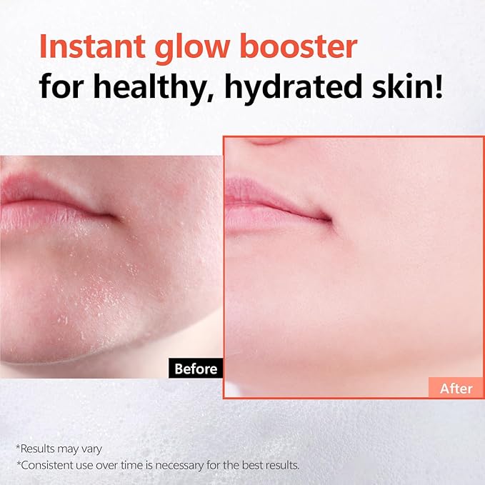 Rice Glow Bubble Toner 3.38 fl oz - Hydrating Milky Toner for Sensitive and Dry Skin, with Niacinamide and Rice Extract to Support Radiant Skin, Easy-to-Carry Size for Daily Korean Skincare Routine