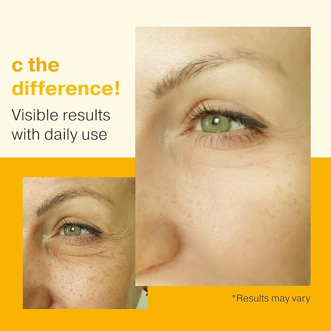 Double Size (2oz), 20% Vitamin C Serum for Face, Hyaluronic Acid, Vitamin C for Face Serum for Women