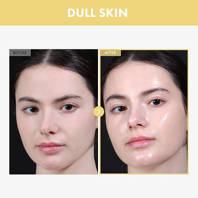 TOSOWOONG Glow Bean Essence, 31,025ppm Soybean Ferment Extract, Glass Skin, Exfoliating, Hydrating, Radiant, Moisturizer, Barrier, Face Serum, Korean Skin Care, 33ml / 1.11 fl. oz.