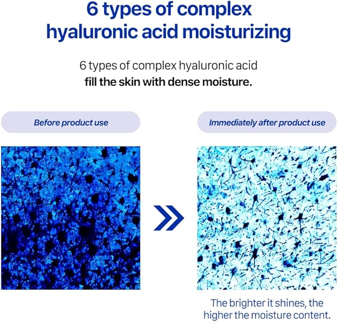 Real Barrier Extreme Essence Toner Light 6.76 Fl Oz | Hyaluronic Acid Panthenol Face Moisturizer for Sensitive Dry Skin | Soothing & Hydrating Moisturizing Toner for Face | Korean Skin Care