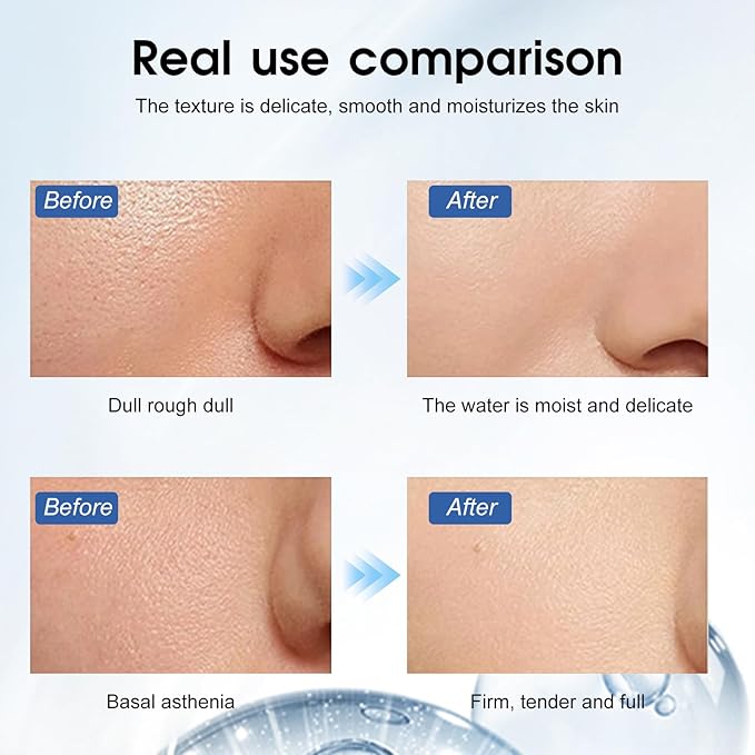 Made in Germany Premium Hyaluronic Acid Serum for Skin Pure Anti Aging Serum Intense Hydration Moisture Non greasy Paraben free, Wrinkle Reducing and Brightening Serum-Hydrating (2 boxes) (2 boxes)