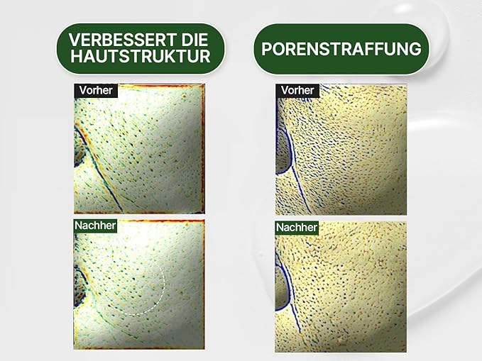 HAMEL Glow 12GF Hyal Essence Toner, Cooling & Moisturizing Booster, Pore Tightening & Radiant Glow with Peptides & 10,000ppm of Hyaluronic Acid, Unscented, Vegan, Cruelty Free, 6.76 fl.oz.