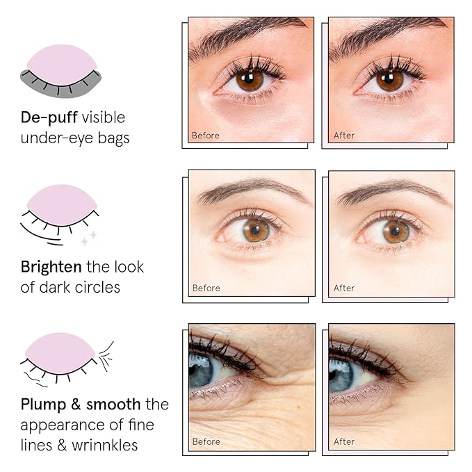 grace & stella Under Eye Patches (12 pairs) Eye Masks for Dark Circles and Puffiness - Stocking Stuffers for Women, Christmas Gifts, Birthday Gifts, Bachelorette Party Favors, Bridesmaid Proposal Gift