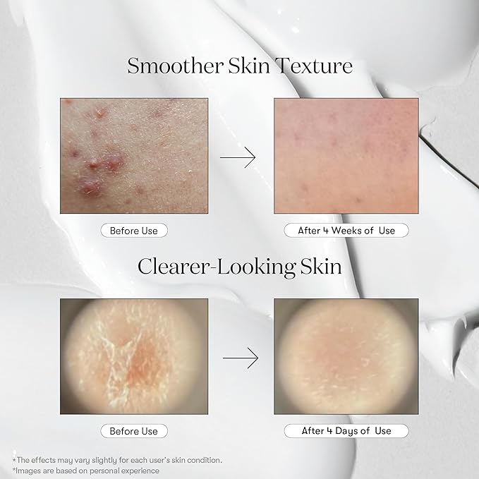 VT COSMETICS CICA Reedle Shot 100, Spicule Microneedling Serum for Pore Care & Exfoliation, Exosome, Centella Asiatica for Glass Skin, Skin Texture, Korean Liquid Skin Booster (1.69 Fl Oz / 50ml)