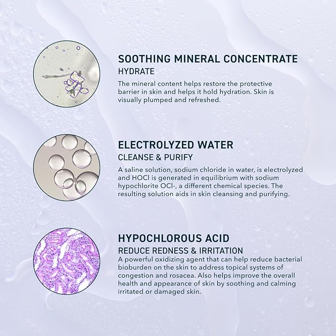 Prequel Skin Universal Skin Solution Hypochlorous Acid Spray for Face and Body. HOCL Facial Cleanser and Dermal Spray with Electrolyzed Water and Mineral Complex. pH-Stabilized Skin Care. 4oz