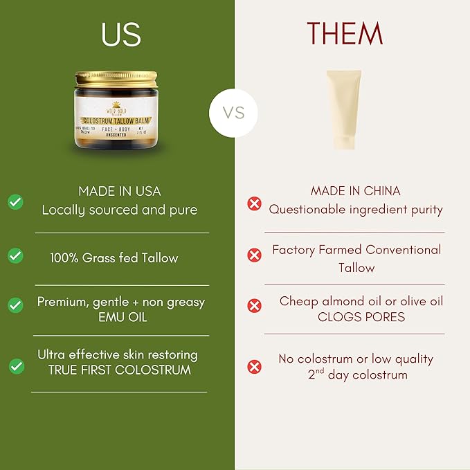 100% Grass Fed Tallow Balm with First Colostrum & Emu Oil - Handmade in USA Whipped Beef Tallow for Face and Body, Sensitive Skin Tallow Moisturizer made with True First Colostrum, (Lavender Mist)