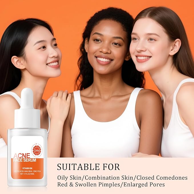 Acne Treatment for Face, Salicylic Acid Serum, Skin Care Essence for Acne, Blackhead, Sebum, Pore, Even out Skin Tone, 1.1fl.oz/30ml