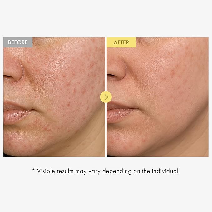 TOSOWOONG Honey Glow 65% Propolis Serum, Hyaluronic Acid, Kojic Acid, Niacinamide, Hydrating Facial Soothing Moisturizer for Irritated Uneven Skin Tone, Glass Skin, Korean Skin Care, 33ml, 1.11 fl.oz.