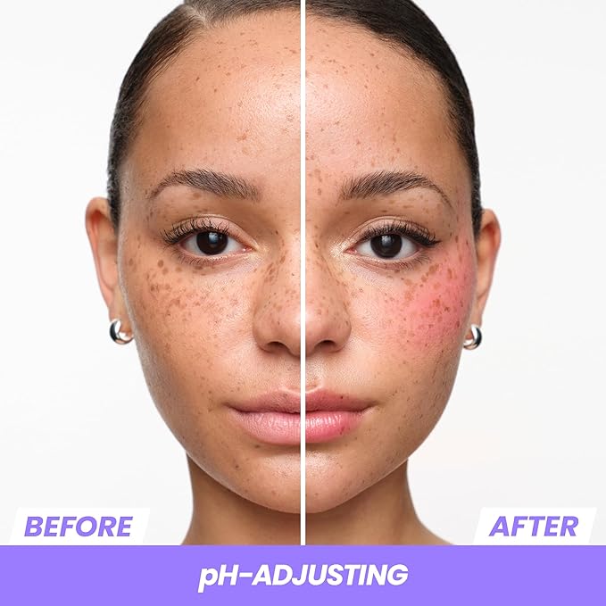 Wonderskin pHlush Stick - Multi-Use Blush Stick, Cream Blush for Cheeks and Lips - pH-Activated, Cooling & Nourishing Cheek Stain Makeup