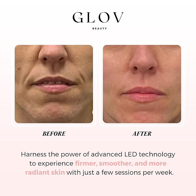 Glov Beauty - Anti-Aging LED Face Mask Red Light Therapy for Wrinkles, Fine Lines & Firmer Skin - Four Color Modes - Easy 10 Minute Session, Rechargeable, Facial Home Spa Device
