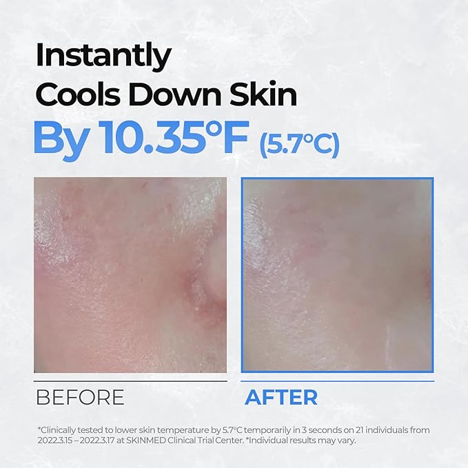 Cell Fusion C Post Alpha Cooling Pad – Hydrating & Cooling Korean Toner Pads | Panthenol & Glacier Water | Hydrating, Depuffing, Pore-Minimizing | 70 Pads / 6.08 fl.oz.