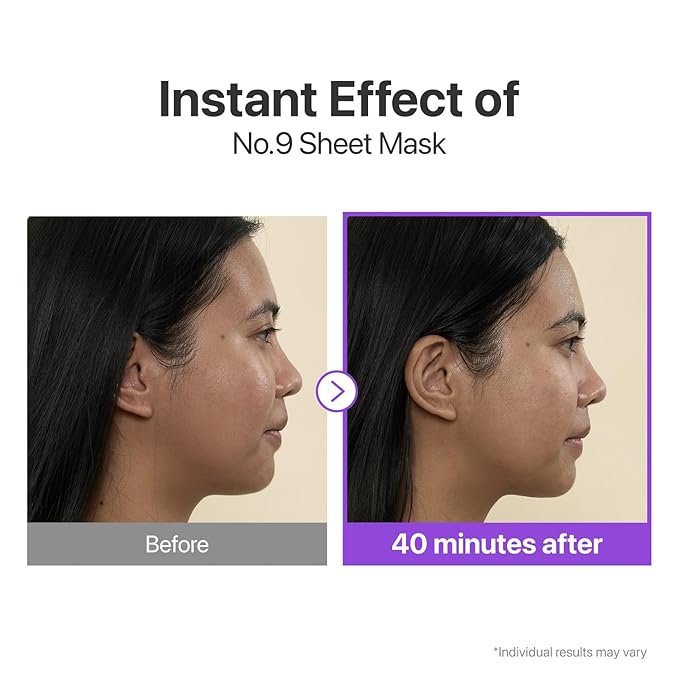 numbuzin No.9 Sheet Mask | NAD+ BIO Lifting-sil Full Face Mask | Improves Jawline, Jowls, Wrinkles, Neck Lines | Peptides, NAD+, Collagen | Skin Firmness | 4 Sheets + Lifting Band