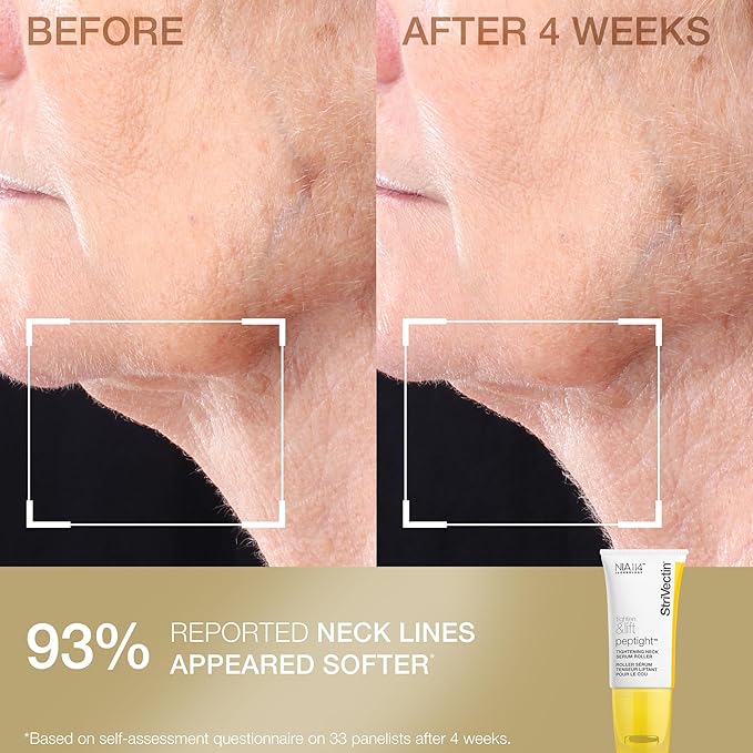 StriVectin Tighten & Smooth Neck Cream and Neck Serum Roller Anti-aging Skin Care 2-Piece Set
