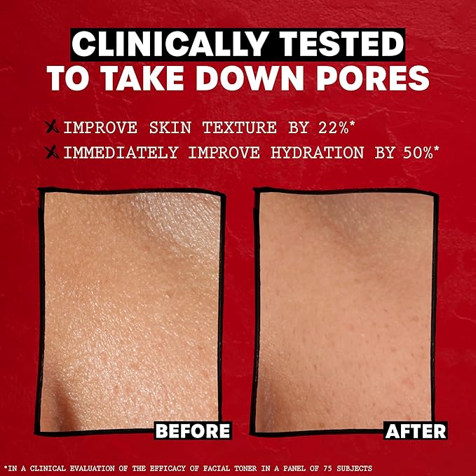 THAYERS Alcohol-Free, Hydrating, Unscented Witch Hazel Facial Toner with Aloe Vera Formula, Vegan, Dermatologist Tested and Recommended, 12 Oz (Packaging May Vary)