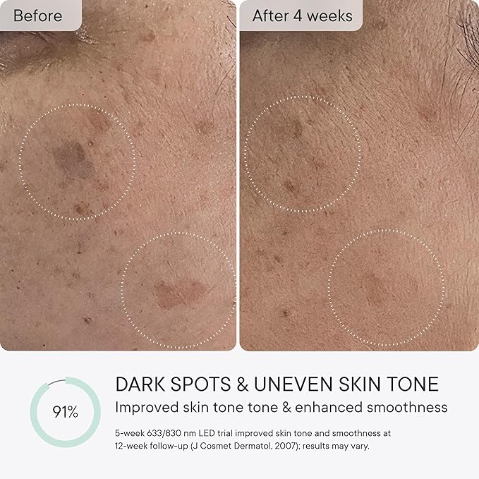 Qure Red Light Therapy for Face – LED Mask with 5 Light Modes for Anti-Aging, Acne, Wrinkles & Dark Spots, 3-Min Wireless Daily Treatments, Smart App Control with Reminders, FDA Cleared