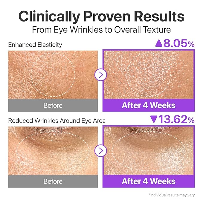 numbuzin No.9 Essence | NAD+ BIO Lifting-sil Essence | Firming, Reduce Wrinkles, Fine Lines | Peptides, NAD+ | Serum for Sagging, Aging, Dull Skin | 1.69 fl. oz.