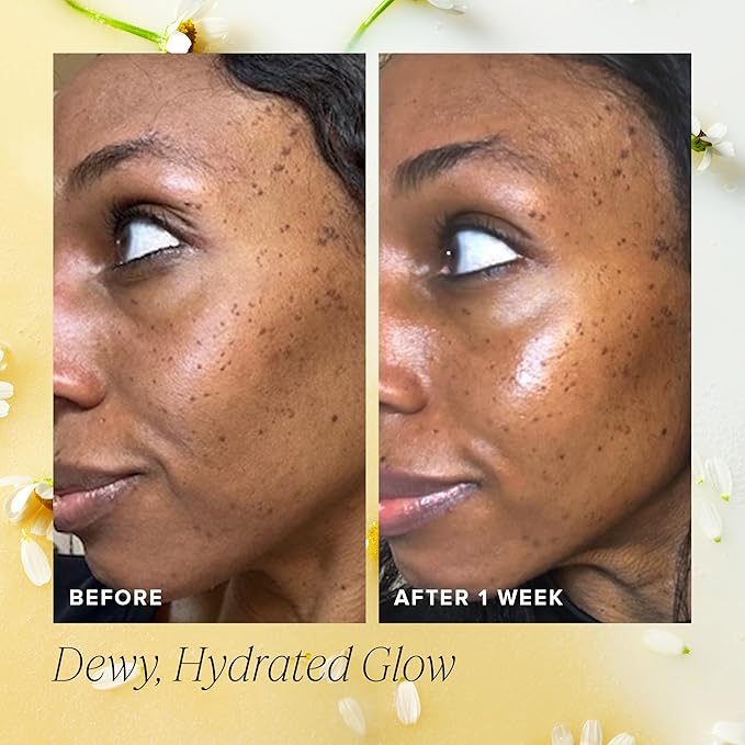 Farmacy Hydration & Barrier Duo - Hydrating Honey Milk Essence (120ml) + Honey Halo Ceramide Moisturizer (50ml) to Soothe, Moisturize & Strengthen Skin for a Healthy Glow