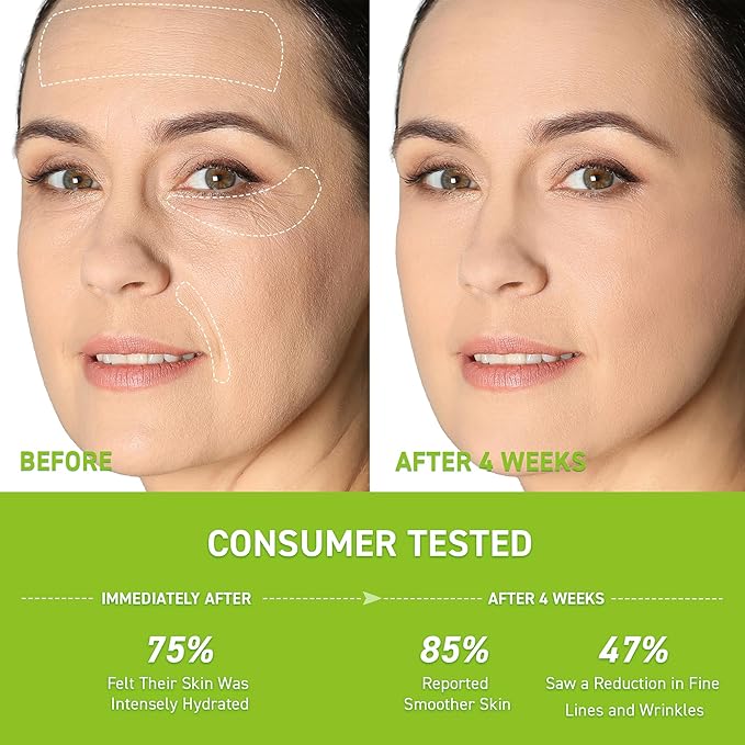 Anti-Wrinkle Retinol Serum for Face: Anti Aging Firming Skin Treatment with Hyaluronic Acid & Collagen - Deep Hydration Facial Care for Women Over 30,Daily & Night Use, 1.0 fl.oz