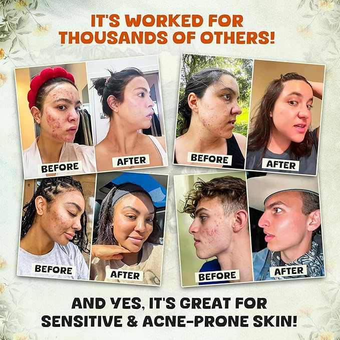 Whipped Beef Tallow and Honey Balm - Moisturizer for Skin, Face, Lips, Body - Natural, Unscented, Non-Toxic Skincare with Manuka Honey - Citrus scented