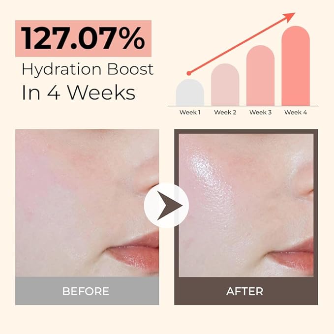 Skin Barrier Recovery Cream, 100-hour Lasting Hydration, Instant Soothing, Moisturizer with Ceramide, Panthenol, Hyaluronic Acid for Dry Sensitive Skin, Hypoallergenic 2.7 Fl Oz/80ml