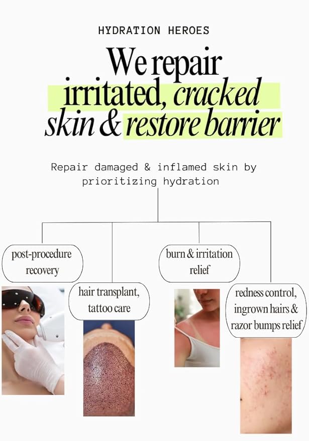 9% Panthenol Intensive Cream – Soothing Redness, Acne, Sunburn & Skin Recovery with Aloe Vera & Hyaluronic Acid – Post-Laser, Facelift, Tattoo, Burn & Hair Transplant Care, 3.4 oz