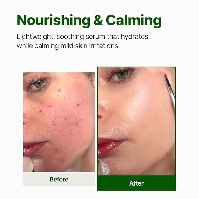 NACIFIC Cica PDRN Calming Serum 1.69 fl oz 50ml – Centella Asiatica, Soothing & Hydrating Barrier Repair Serum with PDRN for Redness Relief and Sensitive Skin, Korean Skincare