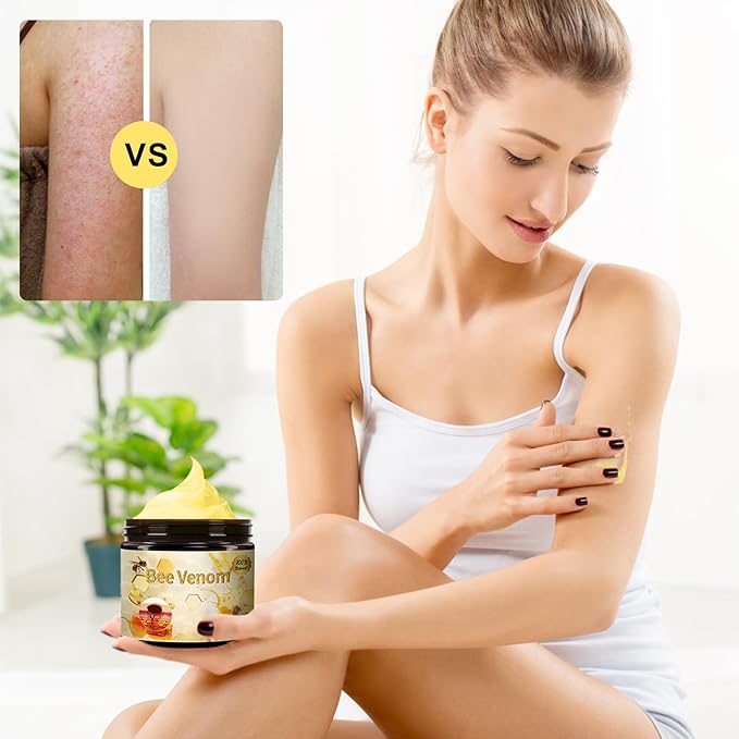 Bee Venom Treatment Cream, 2025 New Professional Bee Venom Repair Cream, For All Body Parts(2 Bottles)