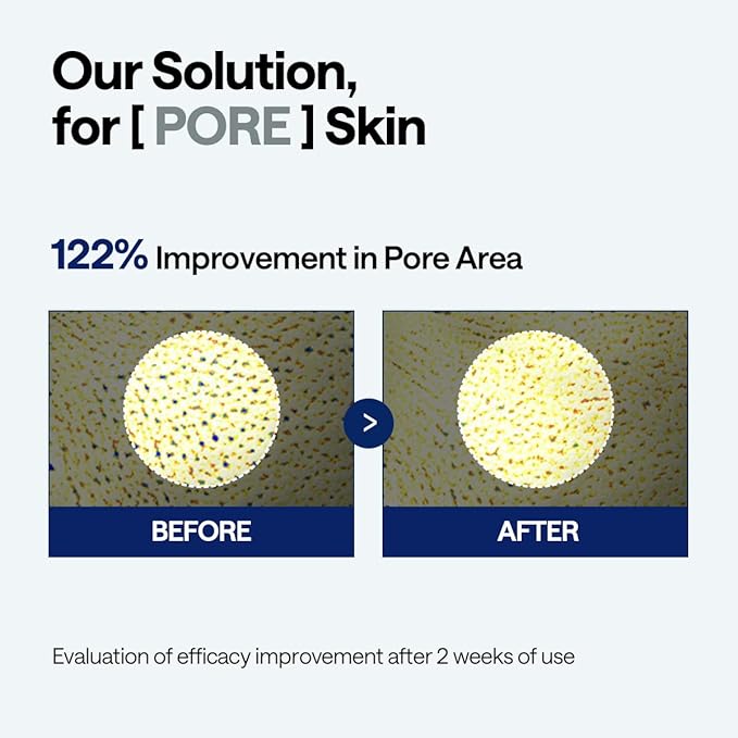 Mediheal Madecassoside Pore Repair Serum 1.35 fl.oz | 2,500 ppm Liposome Spicule & 98.5% Purity Madecassoside Included | Improvement of Pore Spot | Soft Texture for Deep Moisturizing | Non-Irritating