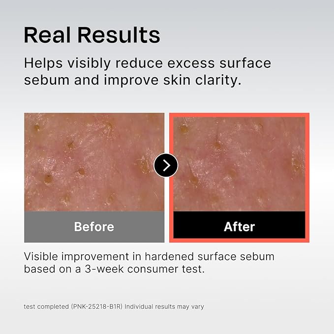 Celladix Sebum Rebalancing Rx 131 Ampoule | Pore Clearing Serum | Tighten Enlarged Pores | Repair Skin Barrier | Rapid Soothing for Daily Use | Oily & Combination Skin| 1.01 Fl Oz