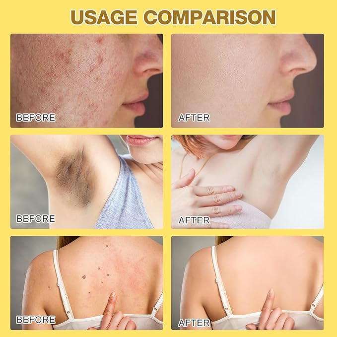 Bee Venom Treatment Cream, 2025 New Professional Bee Venom Repair Cream, For All Body Parts(2 Bottles)