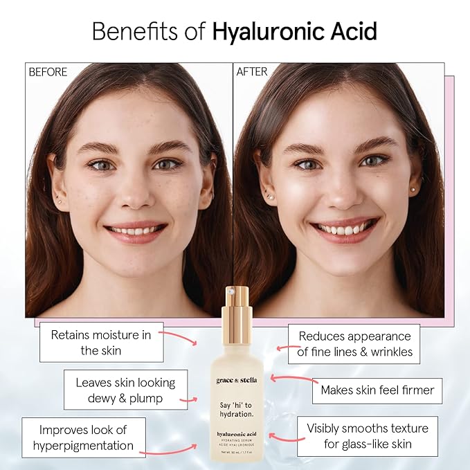 grace & stella Award Winning Hyaluronic Acid Serum (50ml/1.7 fl oz) Hydrating Hyaluronic Acid Serum for Face - Acido Hialuronico for Women - Remove Fine Lines, Wrinkles, Anti Aging - Vegan Skincare