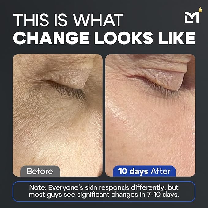 Titan Anti-Aging Peptides Serum for Face – High Potency Mens Peptide Serum Moisturizer – Mens Skin Care – Men, Dark Spots, Wrinkles, Fine Lines – Peptides, 5% Niacinamide, HA – Unscented