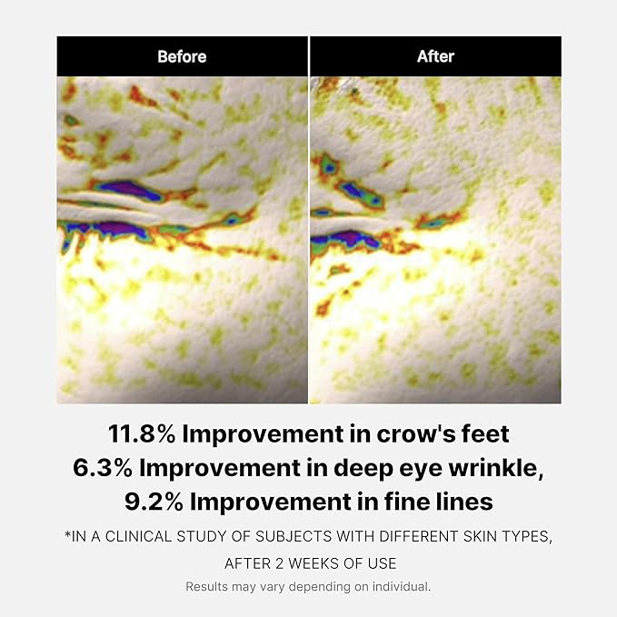 medicube Deep Reviving Peptide Eye Serum 1.01 Fl. Oz., | Eye Treatment Serum with Quadruple Peptides, Niacinamide, and Squalane | Reduces Signs of Aging and Fine Lines