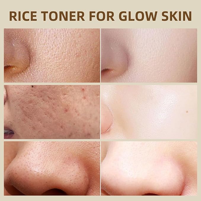 Rice Toner, Hydrating Toner for Face, Facial Toner for Women, Moisturizing, Nourishing, Skin Care for All Skin Types, 4.06fl.oz/120ml